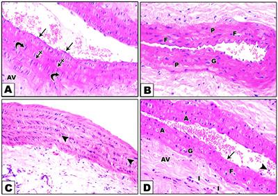 The role of low-carbohydrate, high-fat diet in modulating autophagy and endoplasmic reticulum stress in aortic endothelial dysfunction of metabolic syndrome animal model